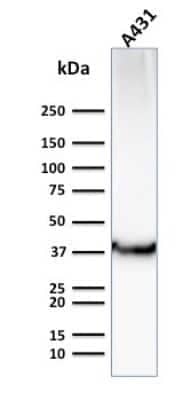 Western Blot: Glut1 Antibody (GLUT1/2476)Azide and BSA Free [NBP2-75787]