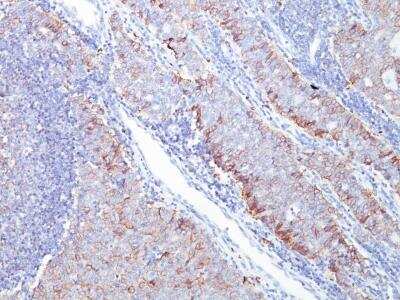 Immunohistochemistry-Paraffin: Glut1 Antibody (GLUT1/2476) [NBP2-75785]