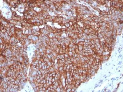 Immunohistochemistry-Paraffin: Glut1 Antibody (GLUT1/3132R) - Azide and BSA Free [NBP3-08502]