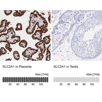 Immunohistochemistry-Paraffin: Glut1 Antibody [NBP2-48609]