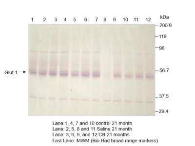 Western Blot: Glut1 Antibody [NB300-666]