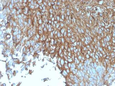 Immunohistochemistry-Paraffin: Glut1 Antibody (rGLUT1/2476) - Azide and BSA Free [NBP3-08479]