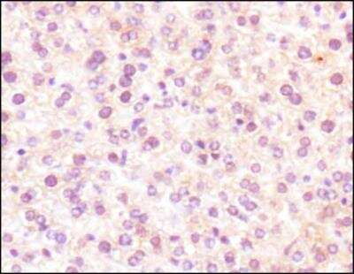 Immunohistochemistry: Glut2 Antibody - BSA Free [NBP2-22218]