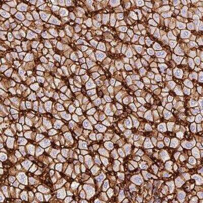 Immunohistochemistry-Paraffin: Glut2 Antibody [NBP2-48586]