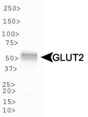 Western Blot: Glut2 AntibodyBSA Free [NBP2-22218]