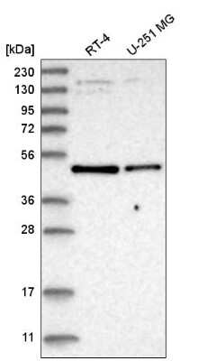 Western Blot: Glut2 Antibody [NBP2-58182]