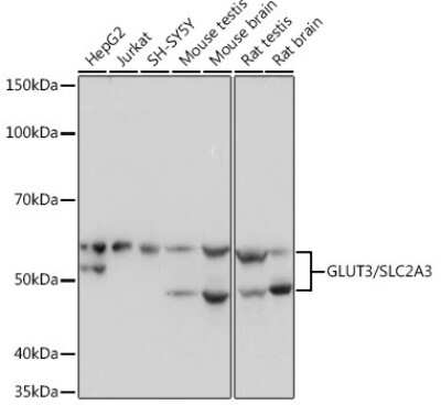 Western Blot: Glut3 Antibody (6T3F2) [NBP3-16340]