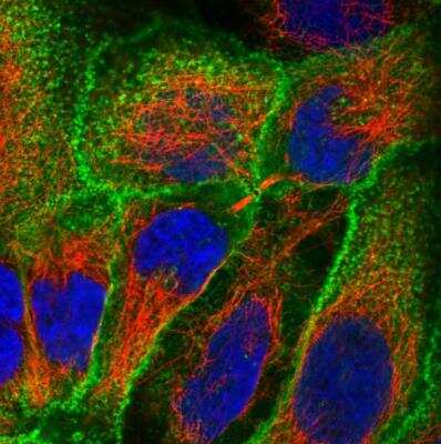 Immunocytochemistry/ Immunofluorescence: Glut3 Antibody [NBP1-89762]