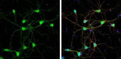 Immunocytochemistry/ Immunofluorescence: Glut3 Antibody [NBP3-12885]