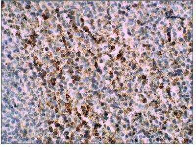 Immunohistochemistry-Paraffin: Glut3 Antibody [NBP3-12237]