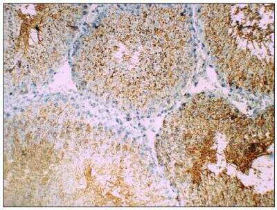 Immunohistochemistry-Paraffin: Glut3 Antibody [NBP3-12237]