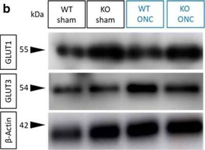 Western Blot: Glut3 Antibody (JA50-31) [NBP2-66872]