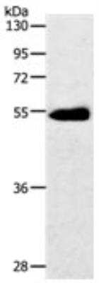 Western Blot: Glut3 Antibody [NBP2-36485]