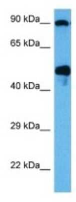 Western Blot: Glut3 Antibody [NBP3-09953]