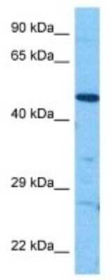 Western Blot: Glut3 Antibody [NBP3-09984]