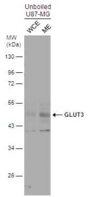 Western Blot: Glut3 Antibody [NBP3-12885]