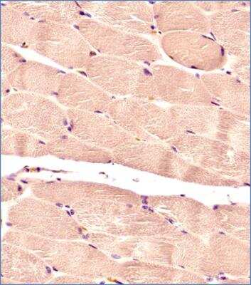Immunohistochemistry-Paraffin: Glut4 Antibody (2E11NB) - BSA Free [NBP2-44299]
