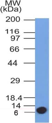 Western Blot: Glut4 Antibody (2E11NB)BSA Free [NBP2-44299]