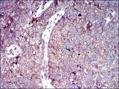 Immunohistochemistry-Paraffin: Glut4 Antibody (3G10A3) - BSA Free [NBP2-22214]