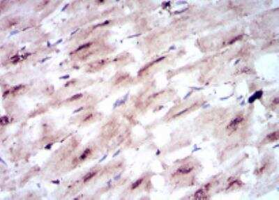Immunohistochemistry-Paraffin: Glut4 Antibody (3G10A3) - BSA Free [NBP2-22214]