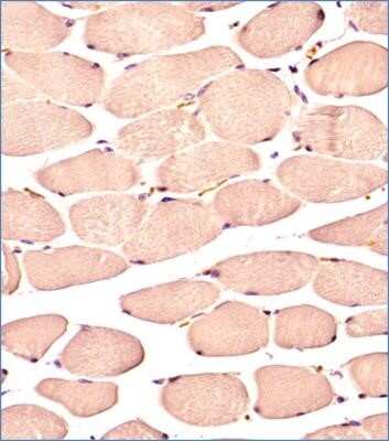 Immunohistochemistry: Glut4 Antibody (6H11NB) - Azide and BSA Free [NBP2-80753]
