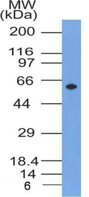 Western Blot: Glut4 Antibody (6H11NB)BSA Free [NBP2-44298]