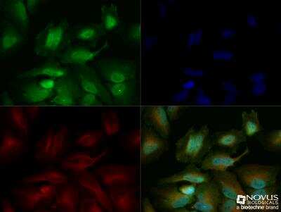 Immunocytochemistry/ Immunofluorescence: Glut4 Antibody - BSA Free [NBP1-49533]