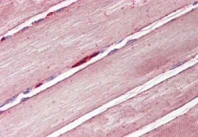 Immunohistochemistry-Paraffin: Glut4 Antibody [NBP1-49840]