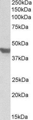 Western Blot: Glut4 Antibody [NBP1-49840]