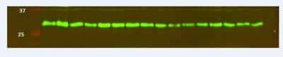 Western Blot: Glut4 Antibody [NBP1-49840]