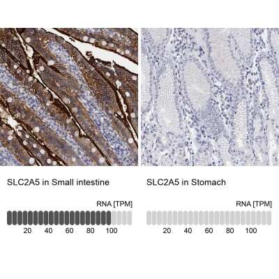 Immunocytochemistry/ Immunofluorescence: Glut5 Antibody [NBP3-17017]