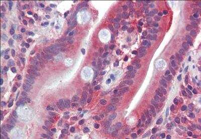 Immunohistochemistry-Paraffin: Glut5 Antibody [NBP1-45227]