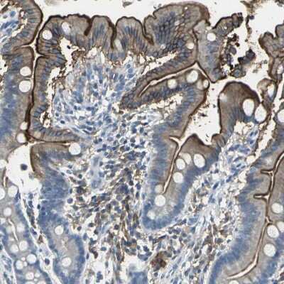 Immunohistochemistry-Paraffin: Glut5 Antibody [NBP1-89761]
