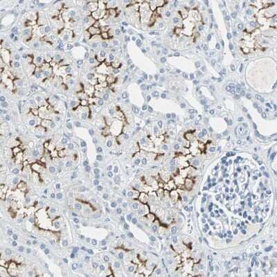 Immunohistochemistry-Paraffin: Glut5 Antibody [NBP1-89761]
