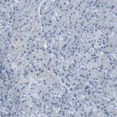 Immunohistochemistry-Paraffin: Glut5 Antibody [NBP1-89761]