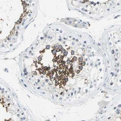 Immunohistochemistry-Paraffin: Glut5 Antibody [NBP1-89761]