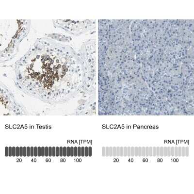 Immunohistochemistry-Paraffin: Glut5 Antibody [NBP1-89761]