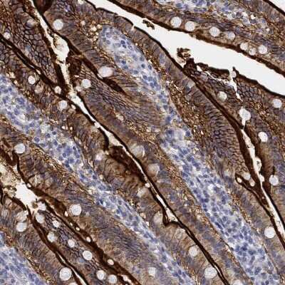 Immunohistochemistry-Paraffin: Glut5 Antibody [NBP3-17017]