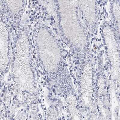Immunohistochemistry-Paraffin: Glut5 Antibody [NBP3-17017]