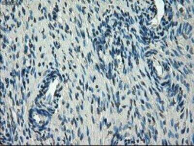 Immunohistochemistry: Glut5 Antibody (OTI9F3) - Azide and BSA Free [NBP2-71285]