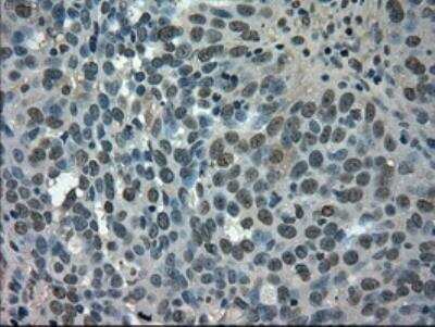 Immunohistochemistry: Glut5 Antibody (OTI9F3) - Azide and BSA Free [NBP2-71285]