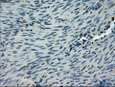 Immunohistochemistry: Glut5 Antibody (OTI9F3) - Azide and BSA Free [NBP2-71285]