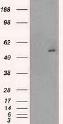 Western Blot: Glut5 Antibody (OTI9F3)Azide and BSA Free [NBP2-71285]