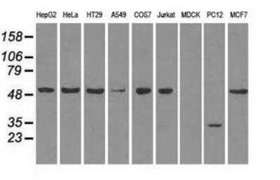 Western Blot: Glut5 Antibody (OTI9F3)Azide and BSA Free [NBP2-71285]