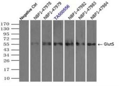 Immunoprecipitation: Glut5 Antibody (OTI9F3) [NBP1-47980]