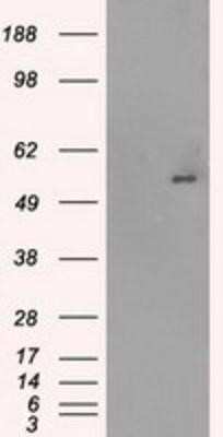 Western Blot: Glut5 Antibody (OTI9F3) [NBP1-47980]