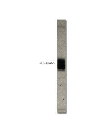 Western Blot: Glut5 Antibody [NBP3-12436]