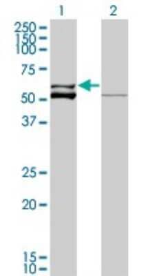 Western Blot: Glutamate Dehydrogenase 2/GLUD2 Antibody (3C2) [H00002747-M01]