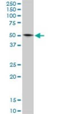 Western Blot: Glutamate Dehydrogenase 2/GLUD2 Antibody [H00002747-B02P]