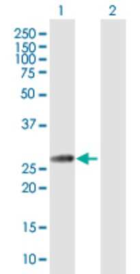 Western Blot: Glutamate Dehydrogenase 2/GLUD2 Antibody [H00002747-B02P]
